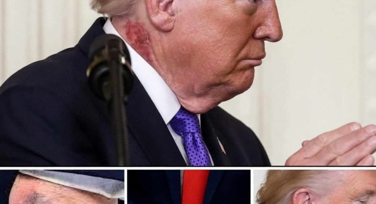 donald Trump shown with visible bruising on his neck and hand in multiple close-up